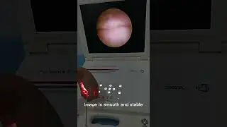 LTES44 Medical Clinic Portable CCD Digital 17 Inches Video Endoscope Camera LED Light