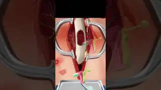 doctor game (part 1 ) #doctor #india #shorts #gameplay #surgerygame
