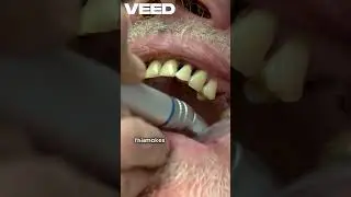 Mouth Chemistry Secrets Revealed