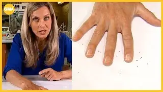 I let ticks crawl on me to test DEET vs. natural insect repellents. Here's what we found
