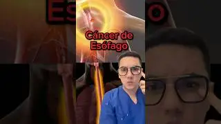 Silencioso pero mortal, as&iacute; es el c&aacute;ncer de es&oacute;fago. #medicina #shorts