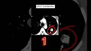 X ray quiz 37 #nursing #nursingstudent #doctor #USMLE  #MBBS, #hospital #anatomy  #ctscan #radiology