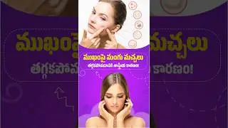 మంగు మచ్చలు తగ్గకపోవడానికి కారణం | Why Don&rsquo;t Dark Spots Fade on Face? | Dr Anand Hair & Skin