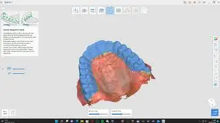 * IDDA MiniBytes - Medit Splint App FULL MANUAL Tutorial - How to Use with ANY Scanner! *