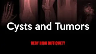 Skeletal Cysts and Tumors X-ray Quiz: Very High Difficulty