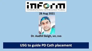 PD Cath Placement by Nephrologist   Aadhil