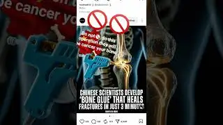 #chinese #chinesescientist #foryou #boneglue#bone #funny #memes #nothingimposibleinthisworld