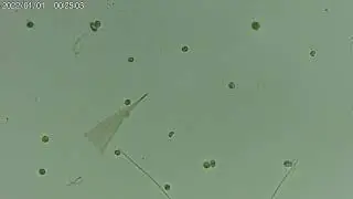 Cyanobact&eacute;ries dont une &agrave; pris une forme &eacute;trange ? des chlamydomonas sont visibles, objectif 40X