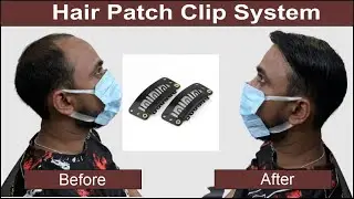 Hair Patch Clip System | Hair Patch Clipping System for Men in Delhi