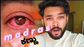 Madras eye 👁️ 
