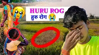 Daya Gi Ched Rog Kana || New Santhali Video ||Huding Boyha Vlogs #HudingBoyhaVlogs