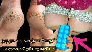 குதிகால் வெடிப்புக்கு ஒரு தடவை இப்படி செஞ்சா போதும் நிரந்தரமாக போயிடும் cracked heels DIY
