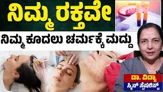 🩸Natural Hair & Skin Cure: ನಿಮ್ಮ ರಕ್ತವೇ ಕೂದಲು ಮತ್ತು ಚರ್ಮಕ್ಕೆ ಸಂಜೀವಿನಿ!✨ | Dr Divya | Kannada News