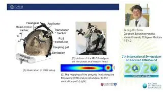 Jeong-Ho Seok - Low-Intensity FUS Stimulation in Patients with Major Depressive Disorder (2020)