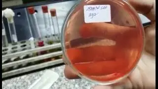 Mod 12 - CVS - Practical Microbiology