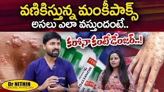 మంకీ పాక్స్ వస్తోందా..? | Dr Nithin About Monkey Pox Treatment in Telugu | Pulse Hospital | PlayEven