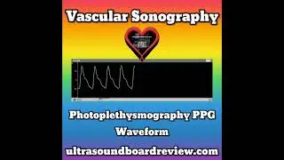 Photoplethysmography Waveforms