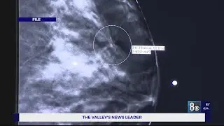 The importance of routine mammograms
