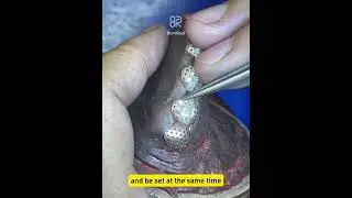 Why  that u should choose us do the invisible setting Grillz! #customjewelry #diamond #