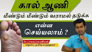 Foot Corns : கால் ஆணி மீண்டும் மீண்டும் வராமல் இருக்க என்ன செய்யலாம் | Dr Balasubramanian