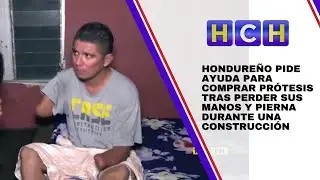 Hondure&ntilde;o pide ayuda para comprar pr&oacute;tesis tras perder sus manos y pierna durante una construcci&oacute;n