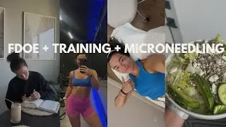 FDOE + Wrokouts + Microneedling Facial