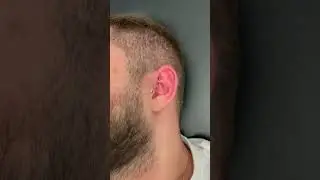 Rook Piercing: Is It Worth the Pain?