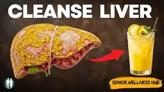 Top 10 SUPER FOODS That Can Heal A FATTY LIVER.