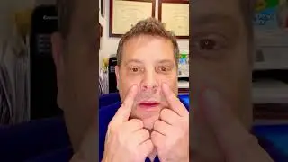 Under Eye Filler Test By Dr. Richard Westreich Of NewFaceNY #filler #botox #juvederm #newyork