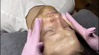 Kemisk Peeling - Mediderma Retises CT Yellow Peel