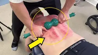 *BREAKING Free* A TIGHT BACK! Other CHIROS Missed GIANT KNOT 😕 Numbness & Back Pain Feel The HEAT