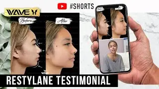 Jan's #Restylane Experience -  Improving her Nose and Chin Non-Surgically #Shorts