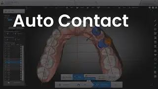 Auto Contact