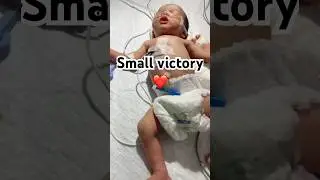 Premature Baby Wins ❤️ | NICU Small Victory |Dr.Muhammad FarrukhMohsin #shorts