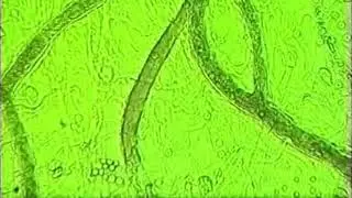 BEMER Circulation Video