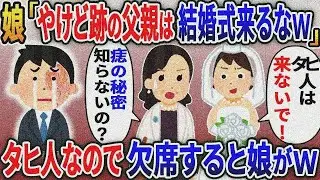 愛娘の結婚式に出席しようとしたら「やけど跡の親父はタヒんだことにしてるから来るな」と追い返された→嫁「あなた知らないの？」娘「え？」黙って出ていくと娘が【総集編】【2ｃｈ修羅場スレ・ゆっくり解説】