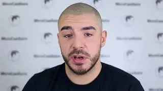 Does scalp micropigmentation capillaire look real? Mathieu Germain | Clinique MicroCapillaire