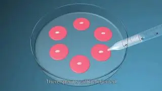 IVF & Multiple Pregnancies I Dr.RadhikaMeka I Parampara Fertility Centre