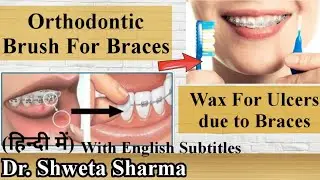 Orthodontic Brush For Braces- Orthodontic Brushing Techniques| Ortho/Interdental Brush For Braces