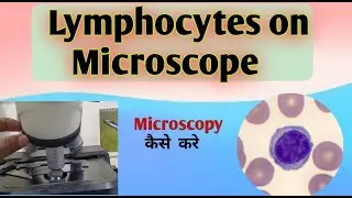 Lymphocytes In Blood Test I high lymphocytes I Lymphocytes under microscope