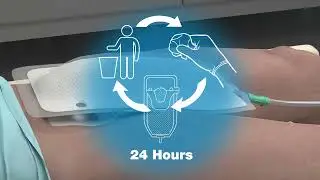 PureWick Male In service video