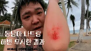 동남아 나짱 해변 무시한 결과 ( 까불다 다침 )