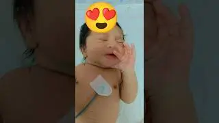 🥰🩺👨&zwj;⚕️🩺@NICU.tech.Shahid #youtube #shortvideos #viral #baby #ytshorts #nicu #officalvideo #india