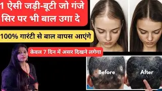 1 ऐसी जड़ी-बूटी जो गंजे सिर पर भी बाल उगा दे