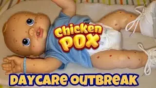 Baby Alive Daycare CHICKEN POX OUTBREAK baby Alive videos