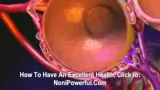 Lung Cancer_NoniPowerful.Com