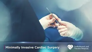Minimally Invasive Cardiac Surgery | MICS | Cardiothoracic Surgery | CTVS Texas