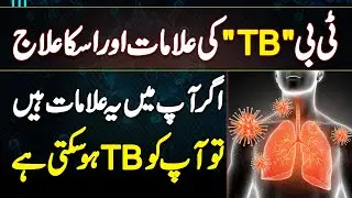 TB Symptoms & Treatment - Tuberculosis Treatment - TB Ki Alamat or TB Ka Ilaj - TB Ka Test Konsa Ha