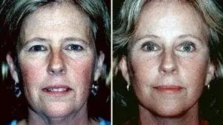 The facial microcurrent commitment