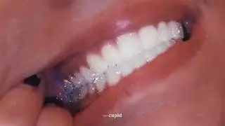 ❝world&rsquo;s most perfect teeth subliminal❞ | -cupid